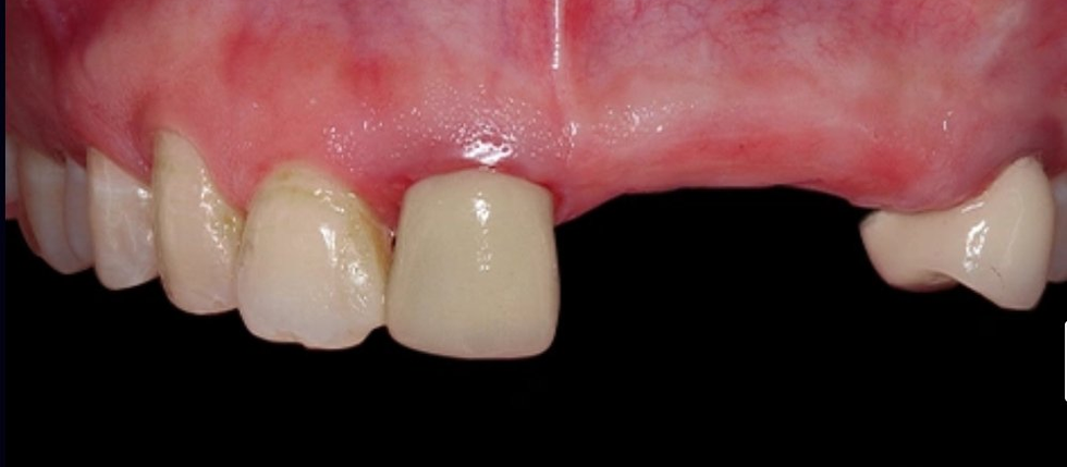 Before treatment